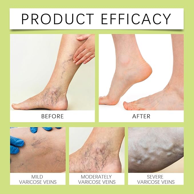 Miracle Balm, Soothing Balm for Joints, Back, Legs & Feet, Non-Greasy (3PCS)-FemmiqueWomen