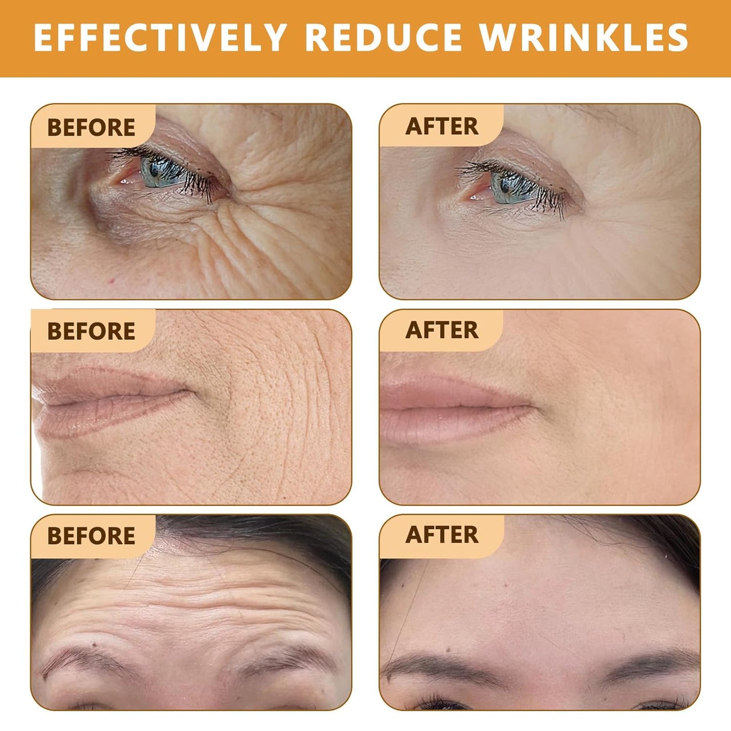 Botoxin Bee Venom Wrinkle Removal Cream, Anti-Aging, Restore and Enhance Skin Elasticity, Natural and Non-Irritating, Suitable for Sensitive, Dry, Oily Skin 0.71 Ounce (Pack of 3)-FemmiqueWomen