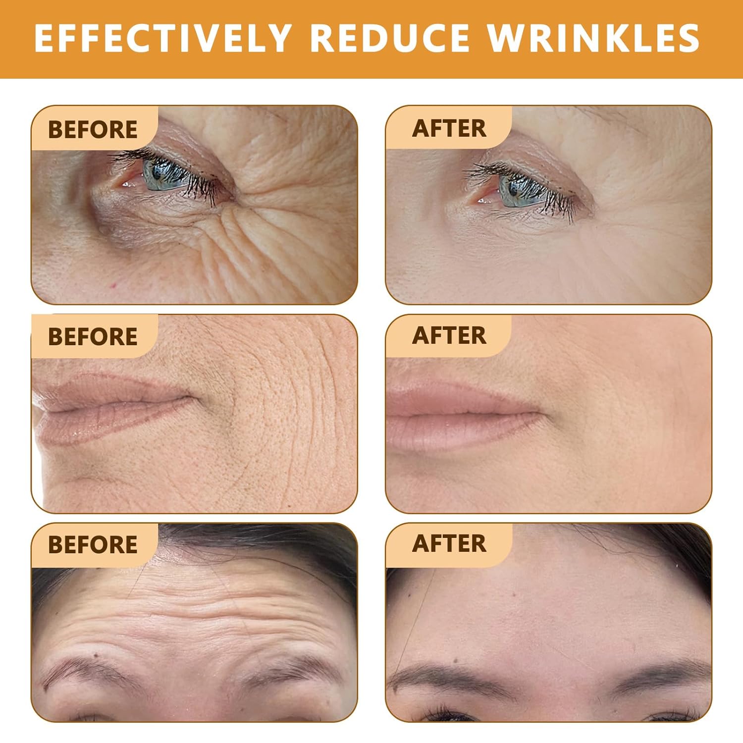 Botoxin Bee Venom Wrinkle Removal Cream, Anti-Aging, Restore and Enhance Skin Elasticity, Natural and Non-Irritating, Suitable for Sensitive, Dry, Oily Skin 0.71 Ounce (Pack of 3)-FemmiqueWomen