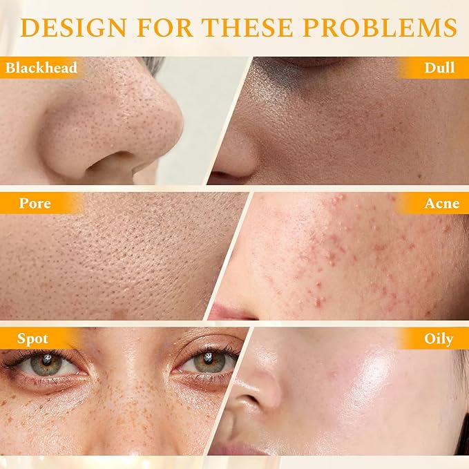 Vitamin C Face Scrub Face Exfoliator Cream Brightening Facial Scrub Exfoliating Facial Wash Microdermabrasion Facial Scrub, Gently Exfoliate Dirt and Dead Skin Cells, Improve Dark Spot, 140g/5oz-FemmiqueWomen