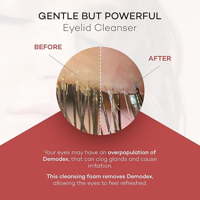 ZocuFoam Eyelid Cleanser - Foaming Eyelid Scrub - Natural pH Balanced Solution - 1.7 FL OZ (50mL)-FemmiqueWomen