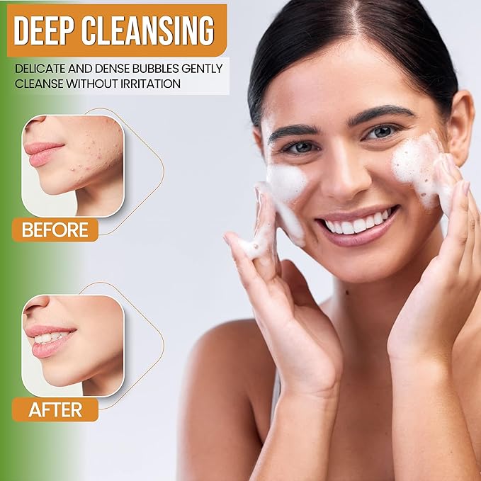 Turmeric Face Wash - Turmeric Facial-Cleanser with Aloe Vera, Vitamin E, and Natural Extracts - Lightweight Daily Gel Face Wash for All Skin Types - 120ml-FemmiqueWomen