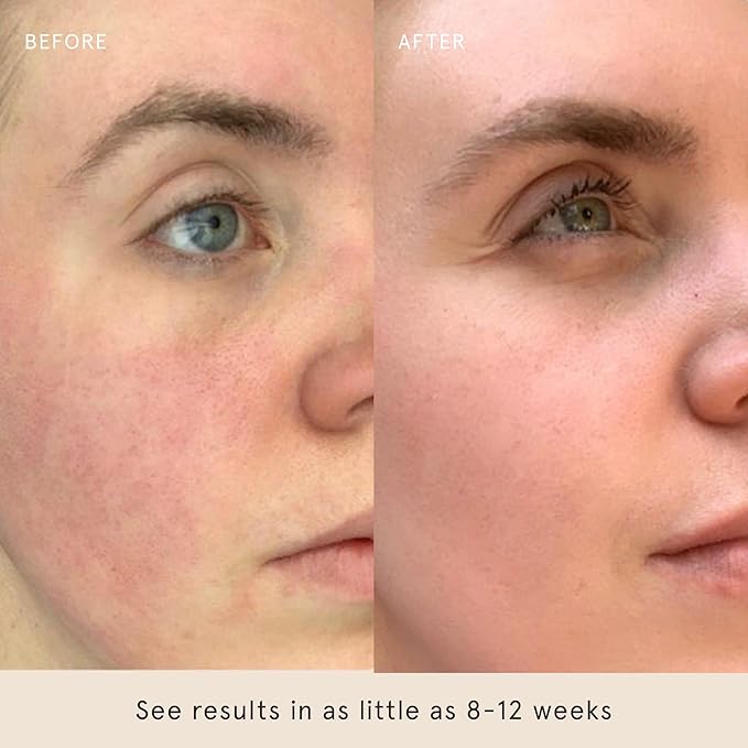 Barefaced Sheer Protection SPF 50+ – Broad-Spectrum Face Sunscreen for women with Zinc Oxide, Niacinamide & Hyaluronic Acid – Oil-Free UV Protection, Hydration & Anti-Aging with Universal Tint (60ml)-FemmiqueWomen