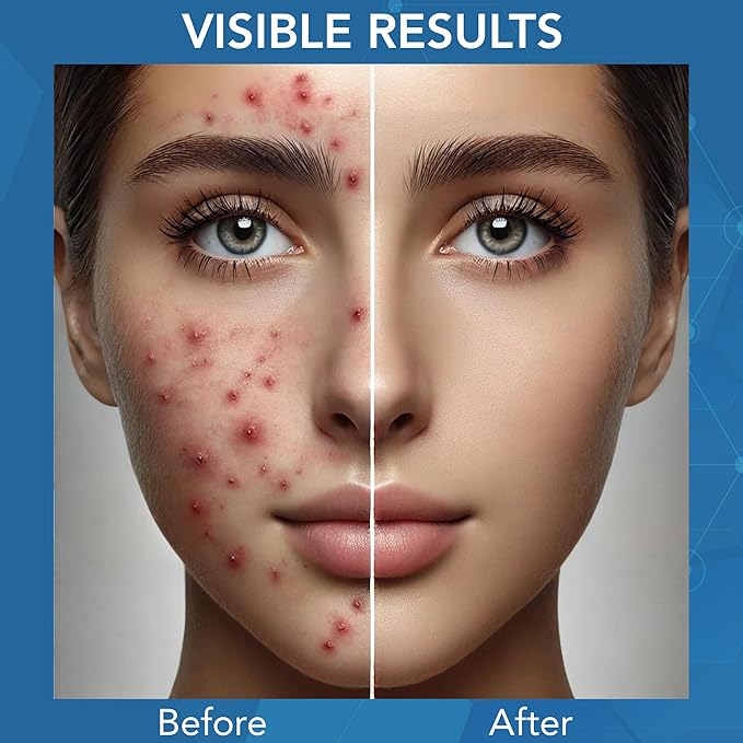 NOVEHA Facial Cleanser For Acne - Hypochlorous Acid Spray - Irritation, Redness & Breakouts Relief - Ideal for Active Teenage & Adult Athletes Post-Workout - Safe for Multiple Daily Uses - 8 oz-FemmiqueWomen