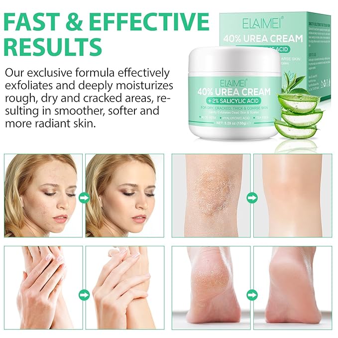J&H Jasmine&Hyacinth 40% Urea Cream with 2% Salicylic Acid, Aloe, Feet/Heel Cream Moisturizer for Dry Cracked Heel, Knees, Elbows, Hands, Callus Remover, Intensive Hydrating Treatment-5.3 OZ/150 G-FemmiqueWomen
