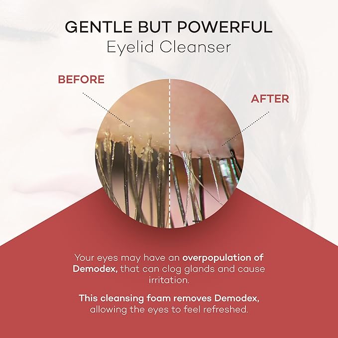 ZocuFoam Eyelid Cleanser - Foaming Eyelid Scrub - Natural pH Balanced Solution - 25mL-FemmiqueWomen