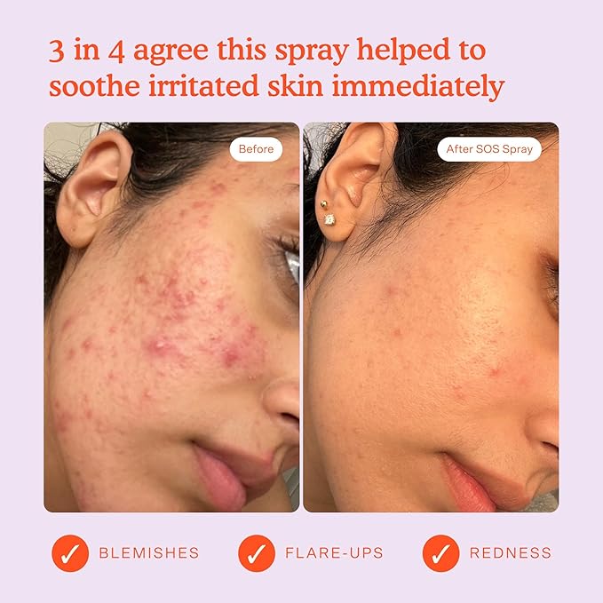 Tower 28 Beauty SOS Daily Rescue Facial Spray Jumbo Refill 16 oz / 480 mL-FemmiqueWomen