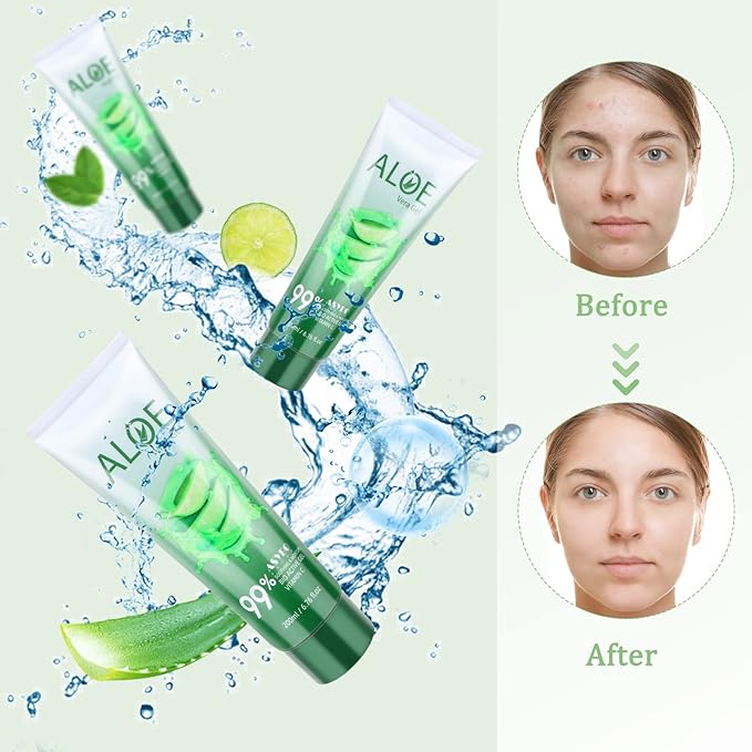 200x2 ML Aloe Vera Gel – 99% Organic Pure Aloe Vera Hydrating Face & Body Moisturizer, Natural Aloe Cream for Dry Skin, Sunburn, Acne, Soothing & Moisturizing-FemmiqueWomen