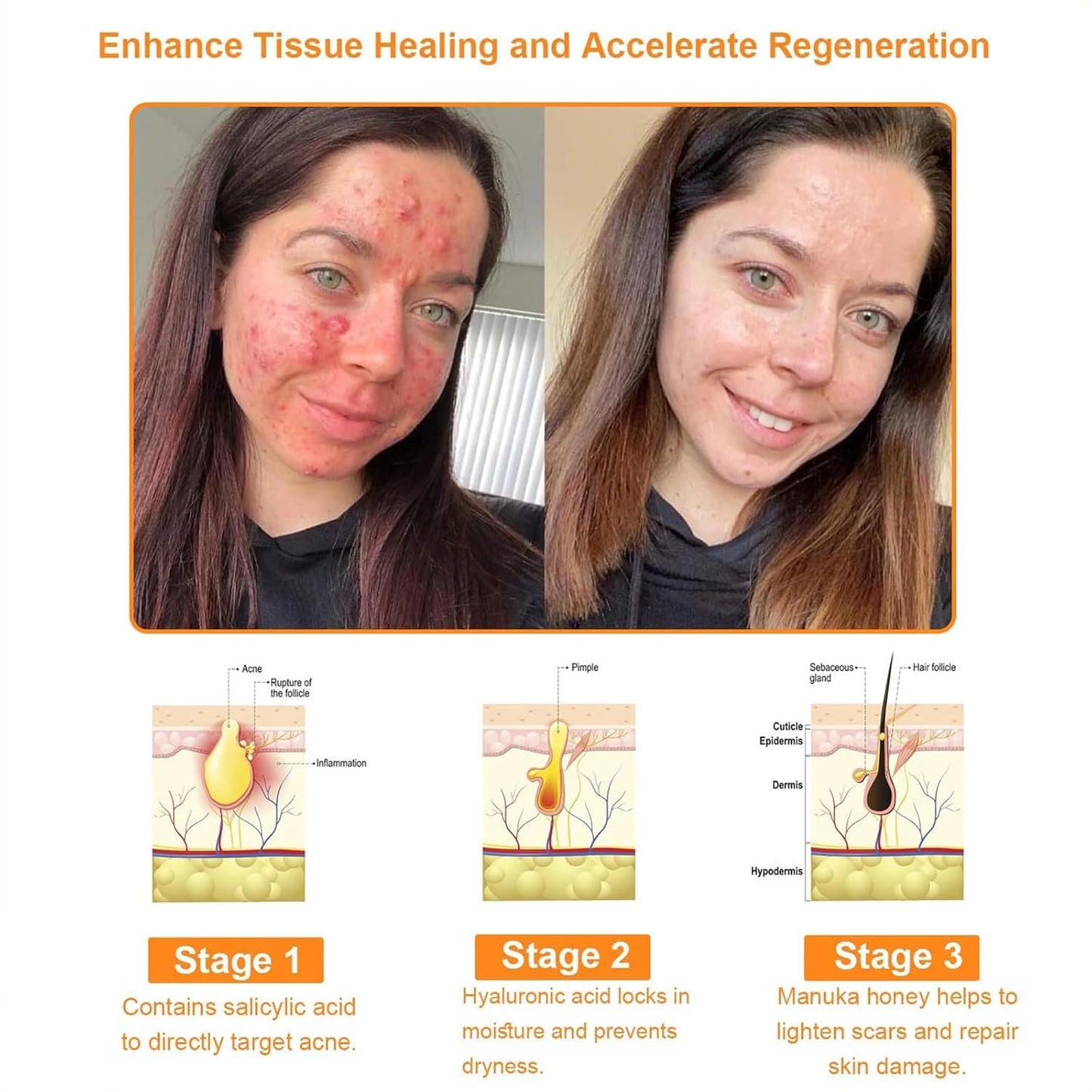 Bee Venom Comprehensive Bee Cream,2025 Professional Treatment Cream Wrinkle Removal Anti-Aging Moisturizing,Effective In Reducing Skin Blemishes (2PCS)-FemmiqueWomen