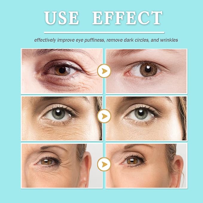 28 Pairs Collagen Eye Mask, Anti Wrinkle Eye Patches for Puffy Eyes and Dark Circles, Natural Marine Collagen Eye Gel Pads for Puffiness, Eye Treatment Skin Care for Puffiness Wrinkle Eye Bags-FemmiqueWomen