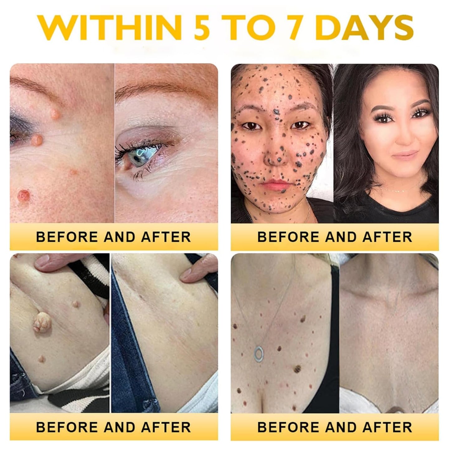 Bee Venom Skin Restoration Cream,Natural Bee Venom Comprehensive Cream,Effectively Firms skin and Reduces Imperfections Anti-Wrinkle Moisturizing for All skin Typess (2PCS)-FemmiqueWomen