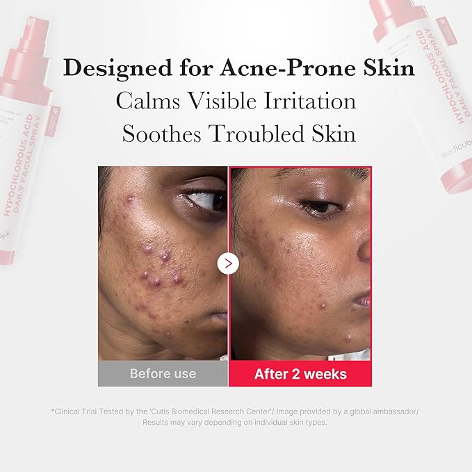 medicube Power Soothing Spray | Hypochlorous Acid Spray For All Skin Types, Delicate Skin | Daily Skin Solution & Post-Sun Care | HOCI Facial Mist for Soothing & Calming | Korean Skincare | 4.22 fl.oz-FemmiqueWomen