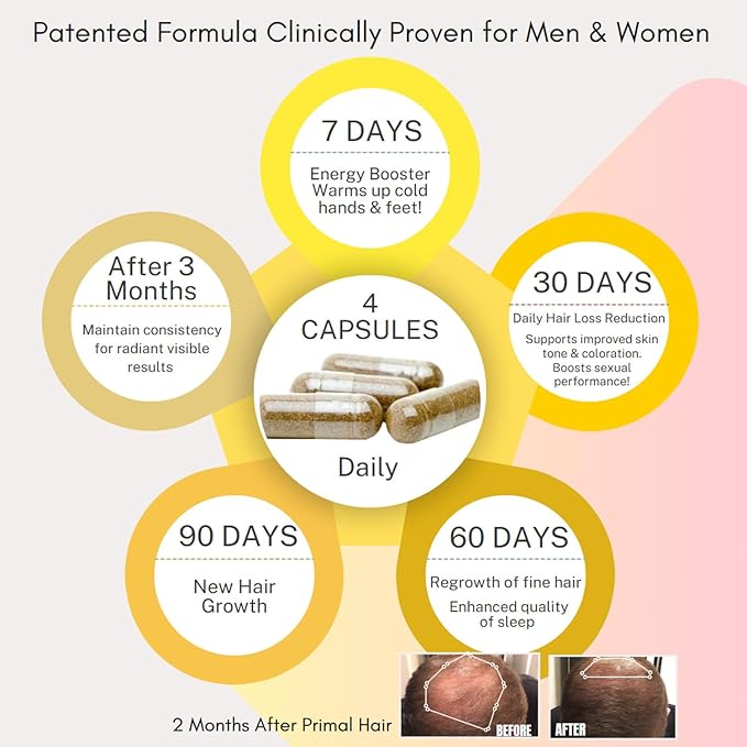 3 PK- 100% Natural Growth Treatment, Reduces Hair Loss, US Patented Formula Proven Effective for Men & Women, 100% Vegan, Non-GMO, 90-Day Supply, 3 Pack-FemmiqueWomen