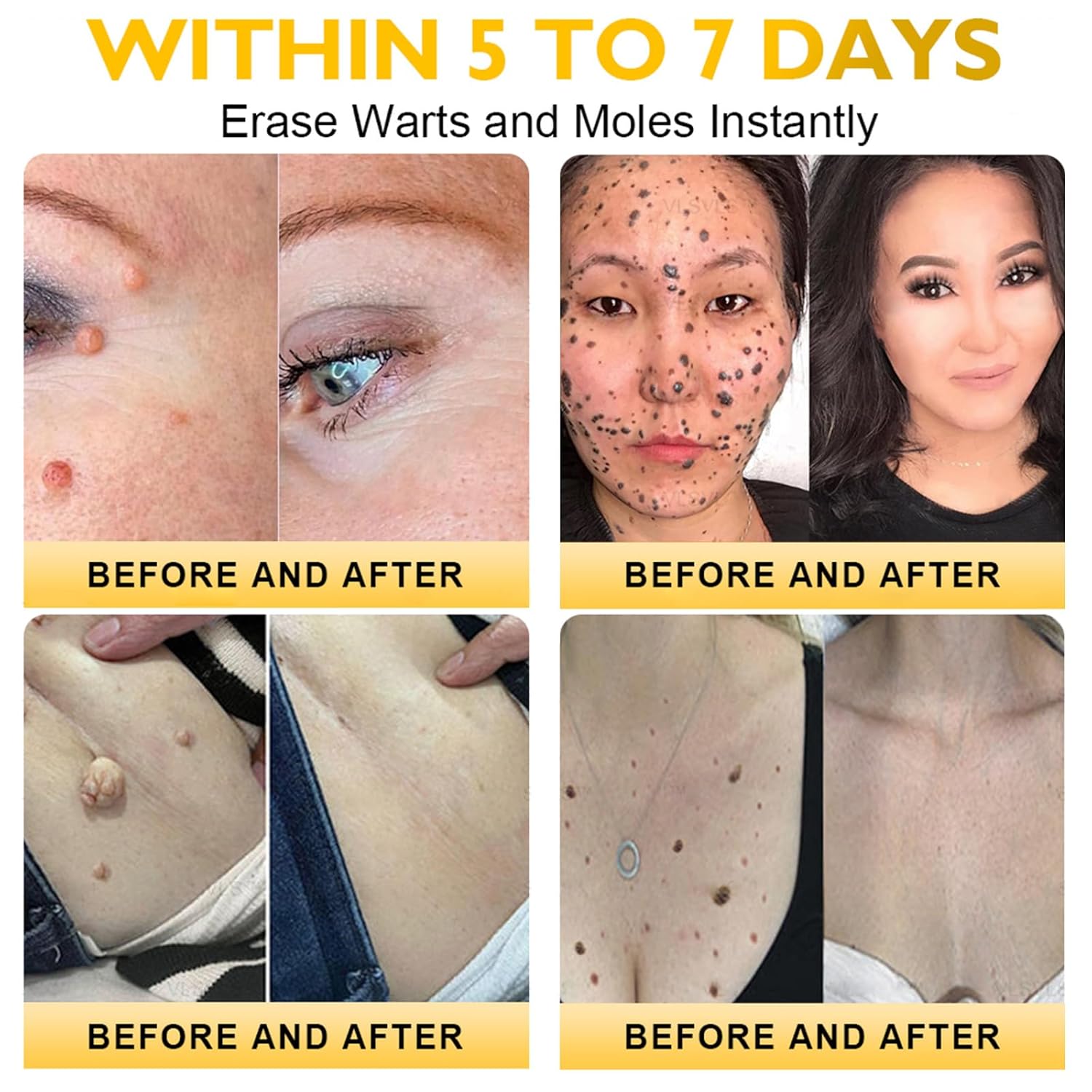 LipMaps Bee Venom skin Restoration Cream,Bee Venom Skin Treatment Cream,Deeply Moisturizing and Firming for All skin Types (4PCS)-FemmiqueWomen