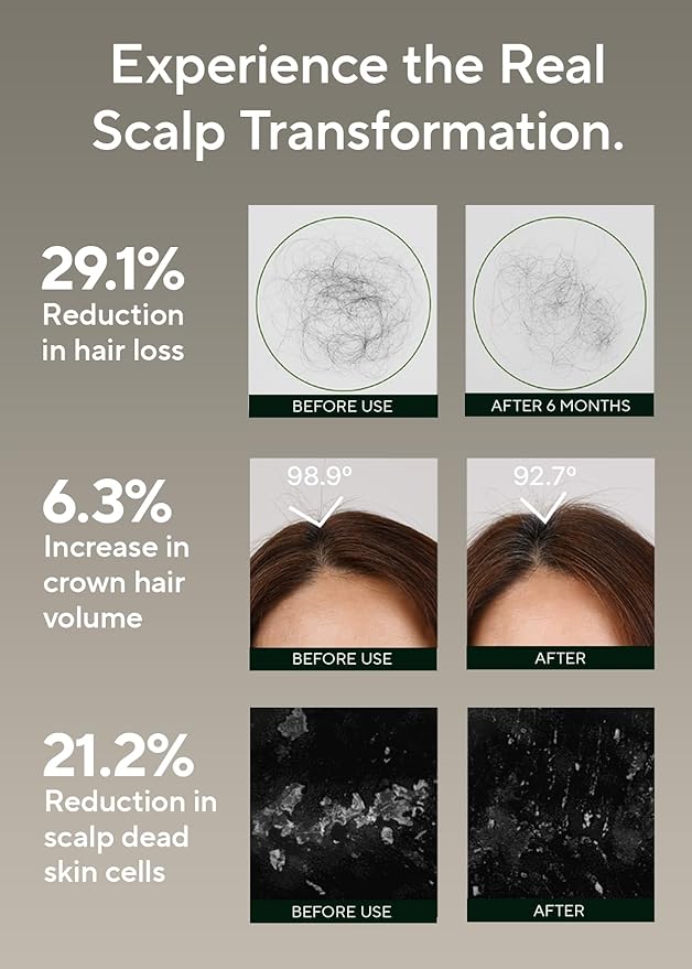 AROMATICA Rosemary Salt Scrub Shampoo - Hair Loss Korean Scalp Detox Shampoo with Rosemary Scalp Oil | Scalp Exfoliator with Salt Scrub for Oily Scalp | Sulfate Free, Silicone Free (10.5 oz / 300g)-FemmiqueWomen