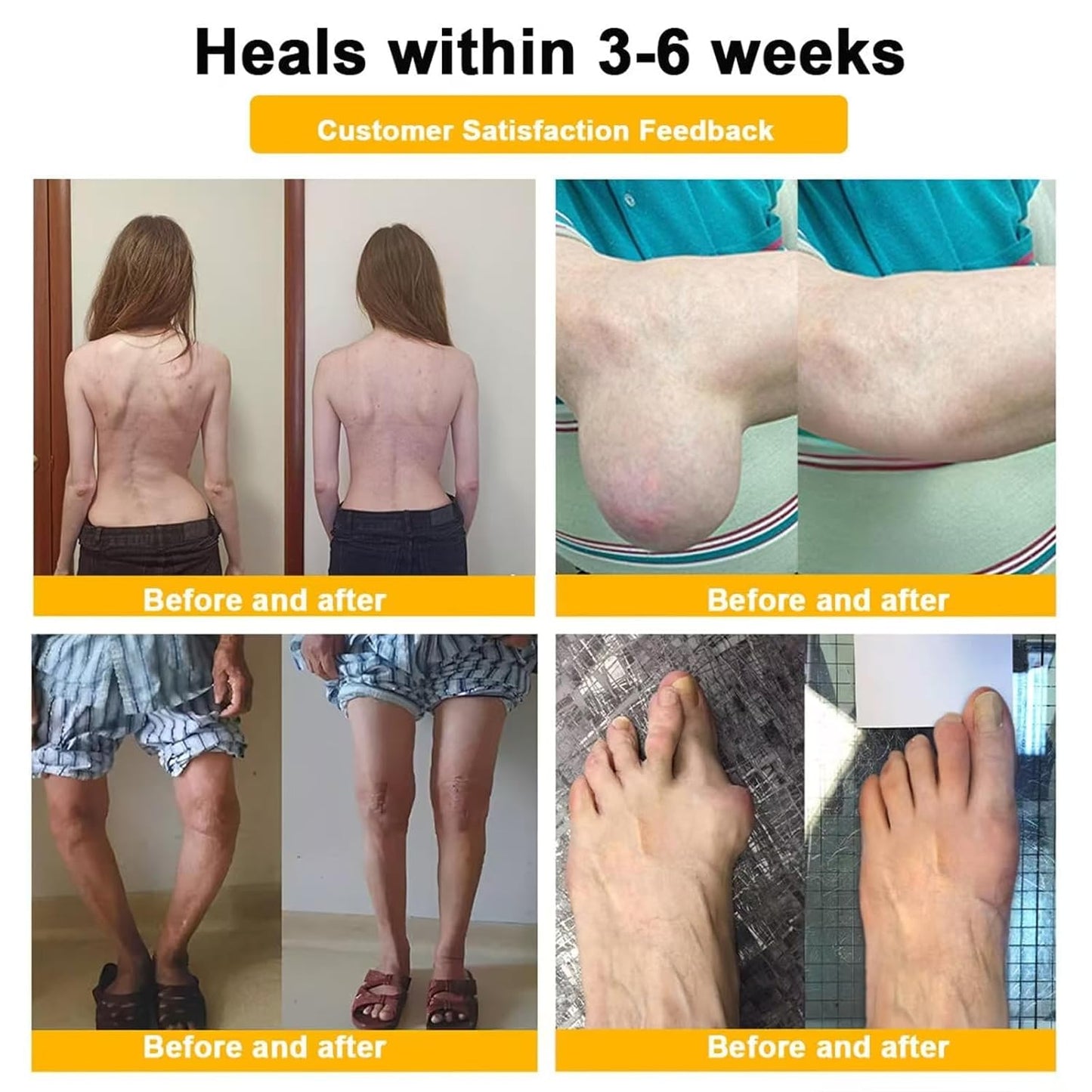 Botulinum Toxin & Bee Venom Pain-Relief Bone Healing Cream, 2025 New Bee Venom Cream for Arthritis, Bee Venom Joint Therapy Pain Relief Gel for Back, Knee, Hands, Neck, Feet, for All Skin Types(2PCS)-FemmiqueWomen