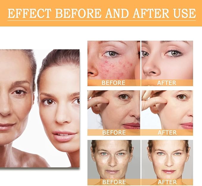 Glycolic Acid Toning Solution, Glycolic Acid 7% Toner, Glycolic Sour 7% Toning, KeepThe Skin Moist, Exfoliating Serum for Face, Facial Exfoliation Astringe Pores (240ML/8.0 Fl Oz)-FemmiqueWomen