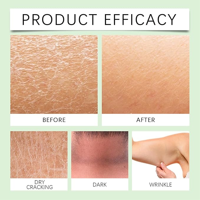 Body Lotion from Korea Whitening Remove Dark Spots, Original Niacinamide Whitening Body Lotion for Dry, Rough & Sensitive Skin, Moisturizing & Nourishing (2)-FemmiqueWomen