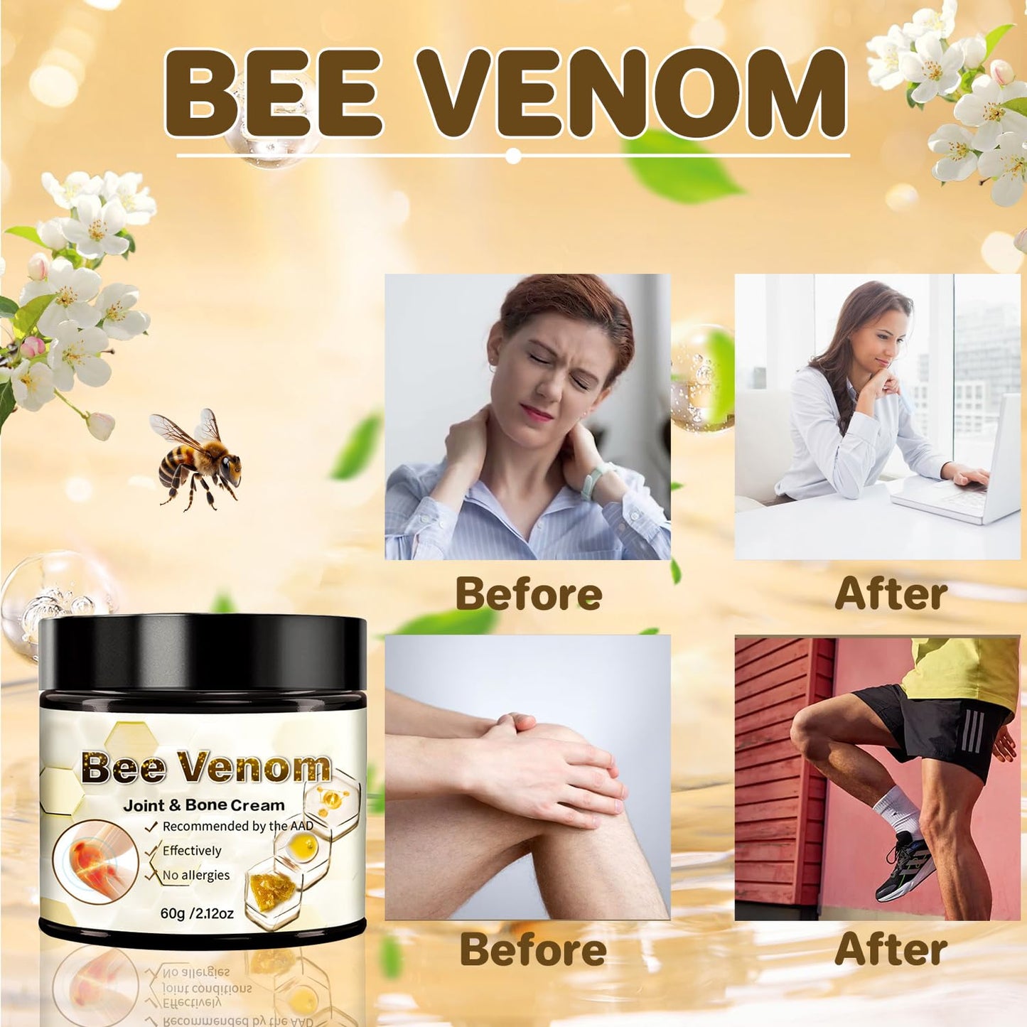 2 PCS Bee Venom Arthritis Cream, Bee Venom Advanced Joint Cream, Bee Venom Joint Relief Cream, Suitable for Back, Neck, Hands, Foot Joints, Etc-FemmiqueWomen
