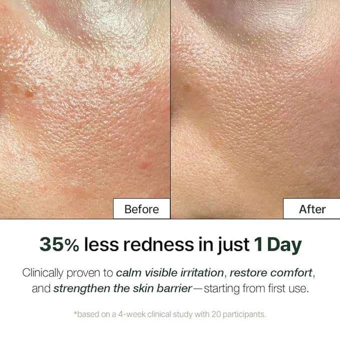 NDP Cica Cream - Gel Face Moisturizer for Sunburn Relief, lightweight Korean Moisturizer for Sensitive Skin, Centella Asiatica, Hydrating, Calming, Soothing (1.7 Fl oz / 50ml)-FemmiqueWomen