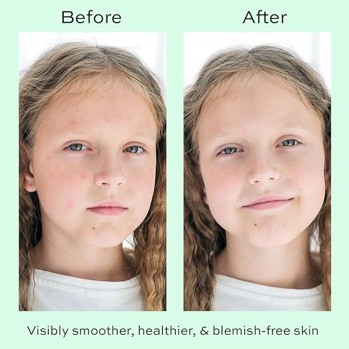Face Moisturizer with Hyaluronic Acid Face Cream for Kids - Facial Cream & Gentle Moisturizer with Strawberry Extract & Vitamin E - Daily Facial Cream Moisturizer for Dry & Sensitive Skin 50ml-FemmiqueWomen