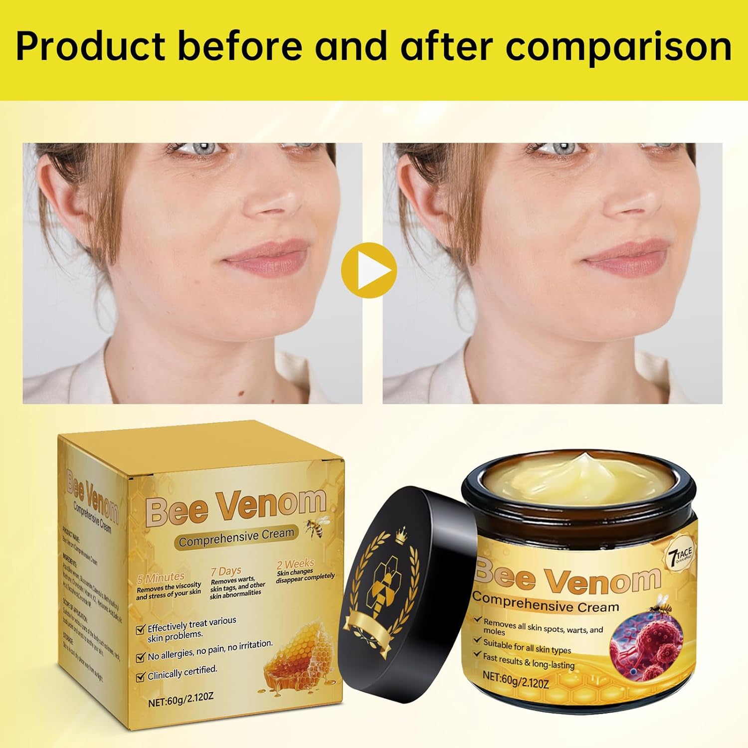 Bee Venom Comprehensive Cream, Firming & Wrinkle-Reducing Deeply Nourishes The Skin, Professional Bee Venom Skin Treatment Cream, Natural Serum Suitable for All Skin Types (2 Pack)-FemmiqueWomen