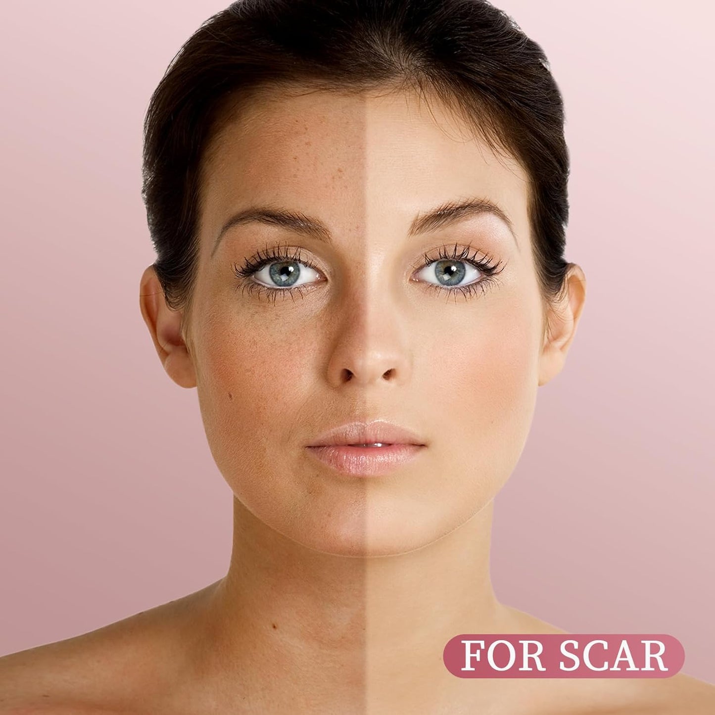 Yoken Rosehip Seed Oil For Face,100% Pure Rosehip oils For Skin,Scars,Hair & Nails.4 fl Oz Cold Pressed Rose Hips Oil For Skin Care, Anti-Aging, Scar Treatment, GUA SHA Massage DIY (4 Fl Oz)-FemmiqueWomen