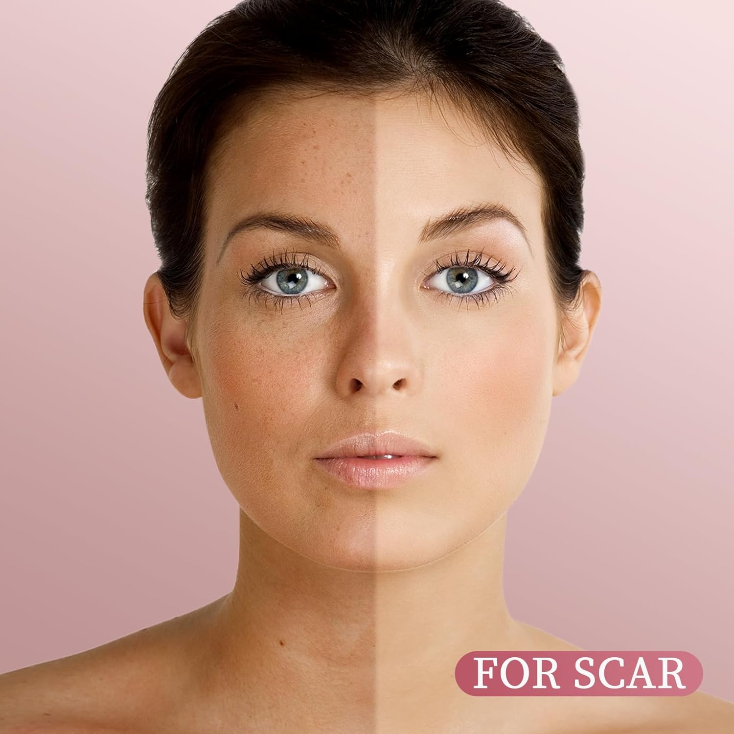 Yoken Rosehip Seed Oil For Face,100% Pure Rosehip oils For Skin,Scars,Hair & Nails.4 fl Oz Cold Pressed Rose Hips Oil For Skin Care, Anti-Aging, Scar Treatment, GUA SHA Massage DIY (4 Fl Oz)-FemmiqueWomen