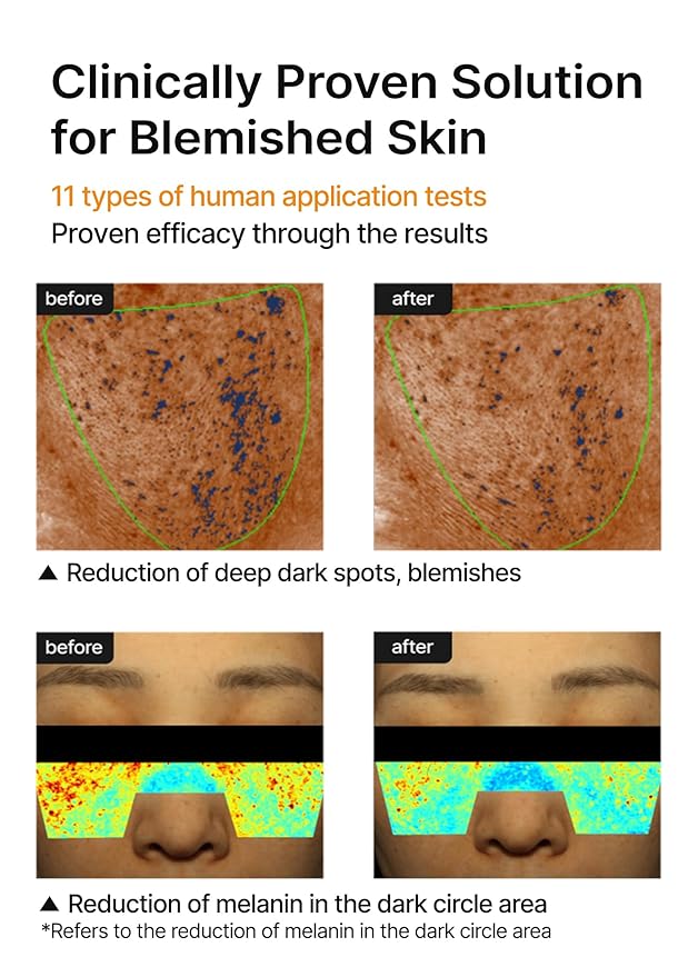 celimax Pore+Dark Spot Brightening Cream | with Niacinamide, Tranexamic Acid, TXA Cream, Pore Minimizer, Non-Irritating, Hydrating, For Sensitive Skin, 35ml-FemmiqueWomen