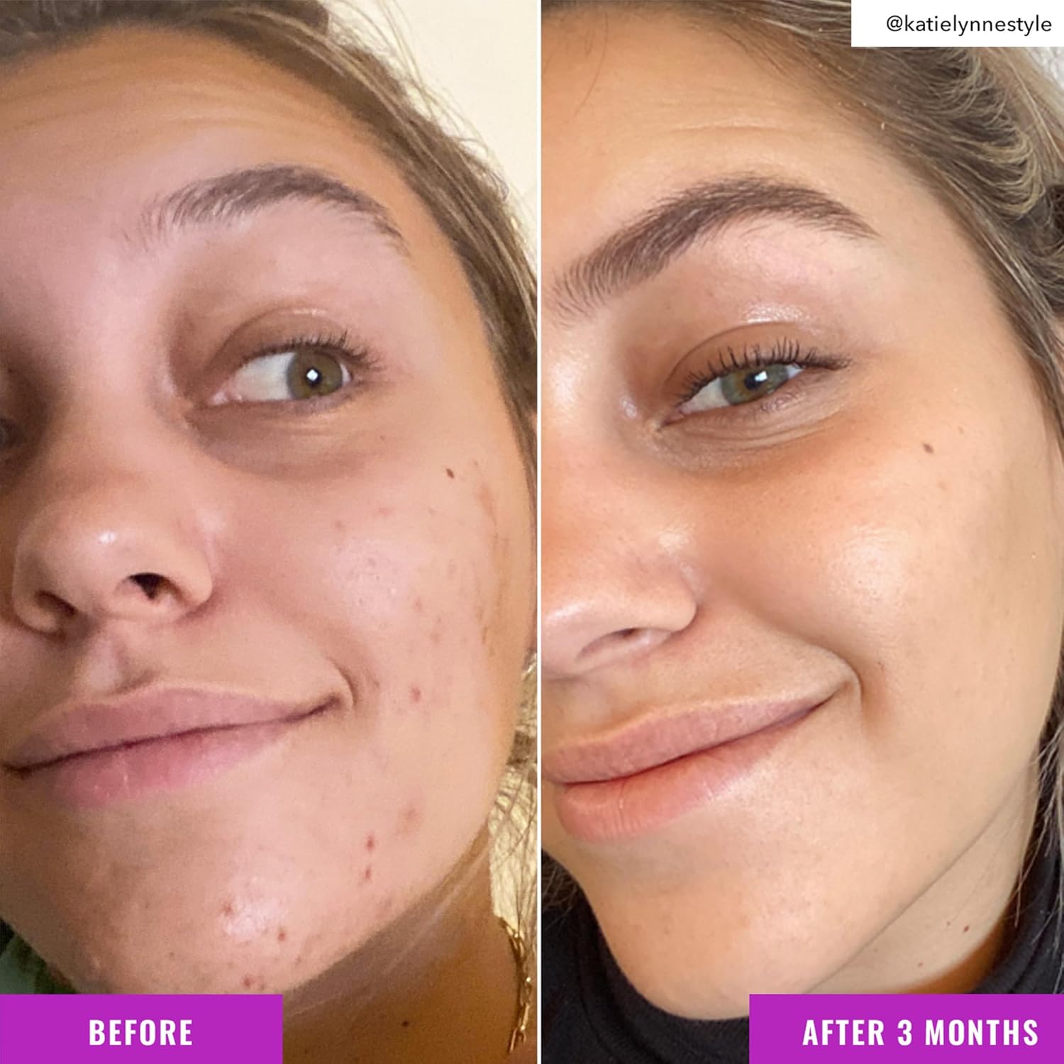 Good Molecules Niacinamide Brightening Toner - Toner for Face with Niacinamide and Arbutin for Skin Tone Balancing- Pore Minimizer, Skin Care for Face-FemmiqueWomen