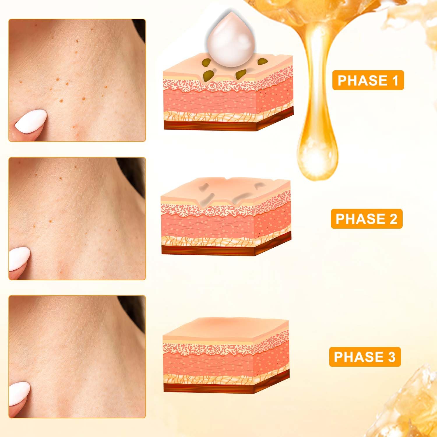 Bee Venom Cream, Professional Bee Venom Cream for All Parts of Neck, Waist, Back, Hands, Feet, and Legs（2Pcs）-FemmiqueWomen