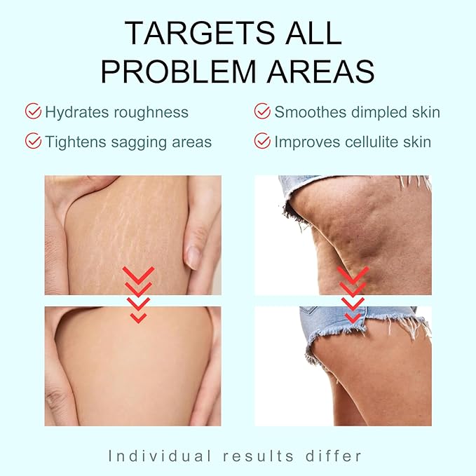 B-TIGHT Body Cream, 200ml Leave-On Booty Enhancing Mask, Firming & Moisturizing Cream, Leave-On Cellulite Mask - Improves Skin Tightness in Buttock Area, Lift sagging skin - 6.76 oz-FemmiqueWomen