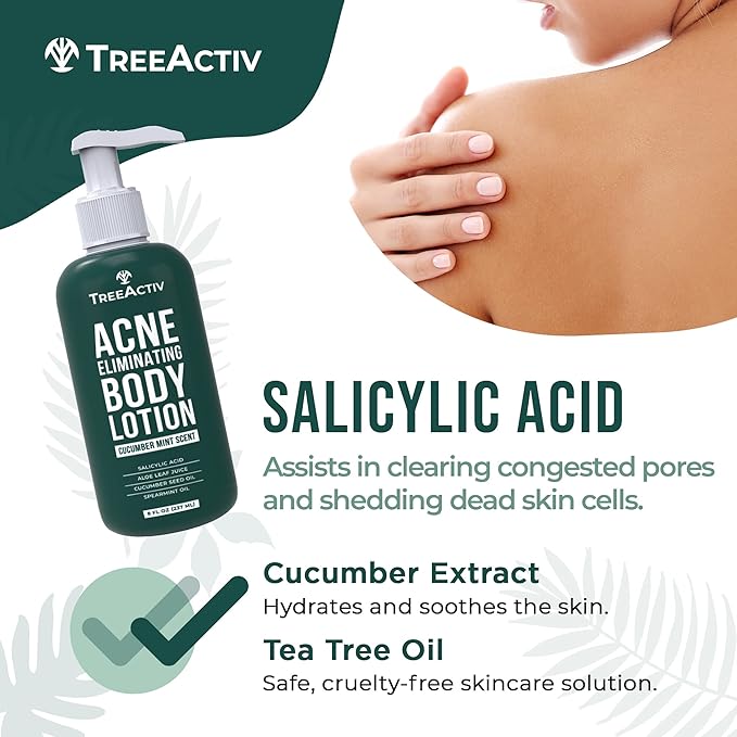 TreeActiv Acne Eliminating Body Lotion 8 fl oz | Clears Body, Back, Butt and Shoulder Acne | Anti-Acne Moisturizer | Prevents Future Breakouts | Cucumber Mint Scent-FemmiqueWomen