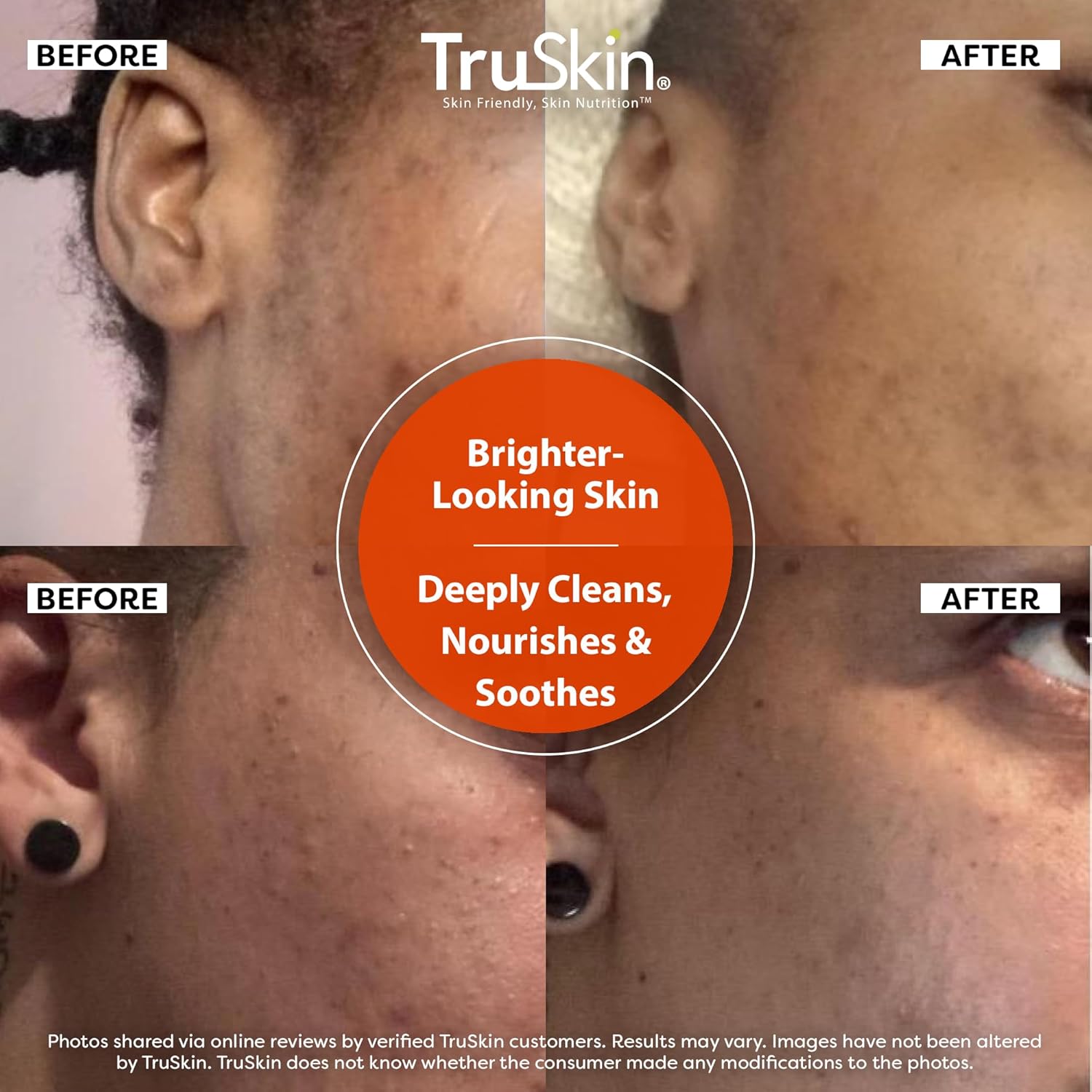 TruSkin Vitamin C Cleanser for Face - Brightening Face Wash with Vitamins C & E, Rosehip Oil, Aloe Vera and MSM - Deep Clean and Refresh for Radiant, Healthy-Looking Skin, 5 fl oz-FemmiqueWomen