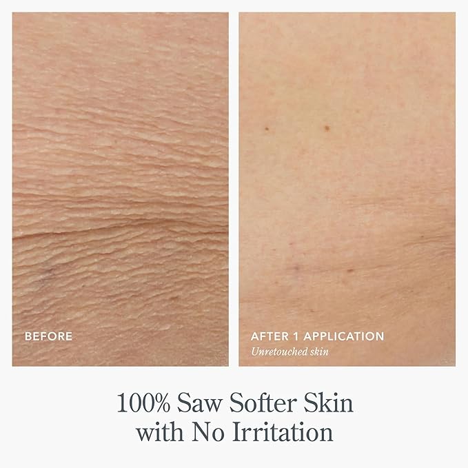 Beekman 1802 Pistachio & Dark Cherry Whipped Body Cream - 8 fl oz - Scented - Moisturizes, Soothes & Softens - With Coconut Oil and Mango Seed Butter - No Irritation - Good for Sensitive Skin-FemmiqueWomen