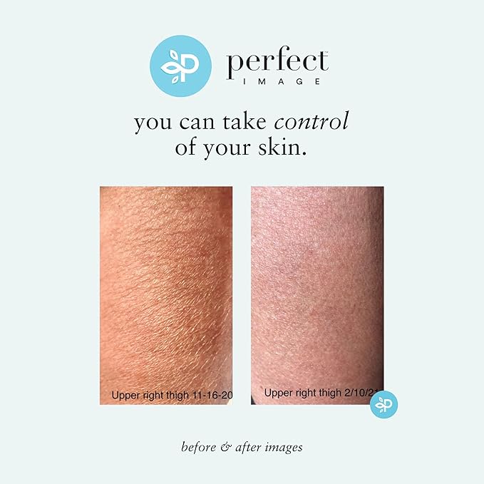 Perfect Image Gly + Sal Exfoliating Body Lotion, 8% Glycolic Acid and 2% Salicylic Acid Lotion Enhanced with Green Tea, Papaya, Bearberry, Licorice and Amino Complex-FemmiqueWomen