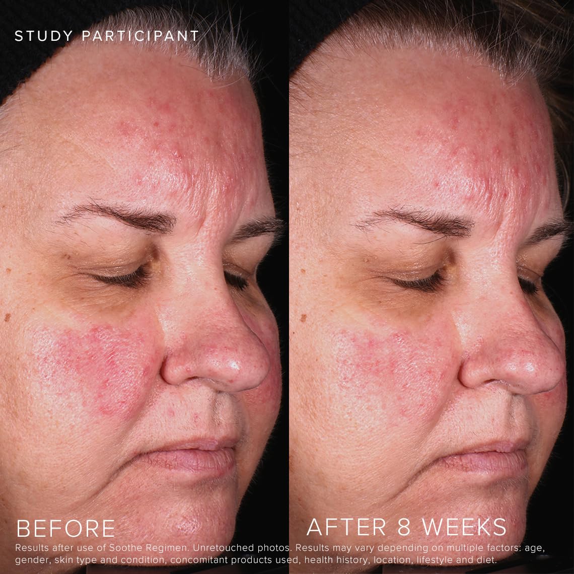 Rodan + Fields Soothe Calming Gel Cleanser | 125 ml | Dry & Sensitive Skin | Moisturizing & Hydrating Skincare-FemmiqueWomen