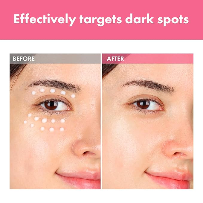 Arbutin 7% Intensive Spot Cream with 70,000ppm Arbutin, 3% Tranexamic Acid, 1% Niacinamide, Glutathione, Dark Spots, freckle, Blemishes, Anti-pigmentation, Korean Skin Care, 20ml, 0.67 fl.oz-FemmiqueWomen