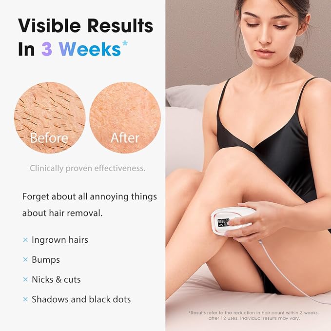 IPL Laser Hair Removal Device for Women & Men - Home 45°F Ice-Cooling Contact for Painless & Long-Lasting Results, 86% Hair Reduction in 3 Weeks for Full Body & Bikini Line, White-FemmiqueWomen
