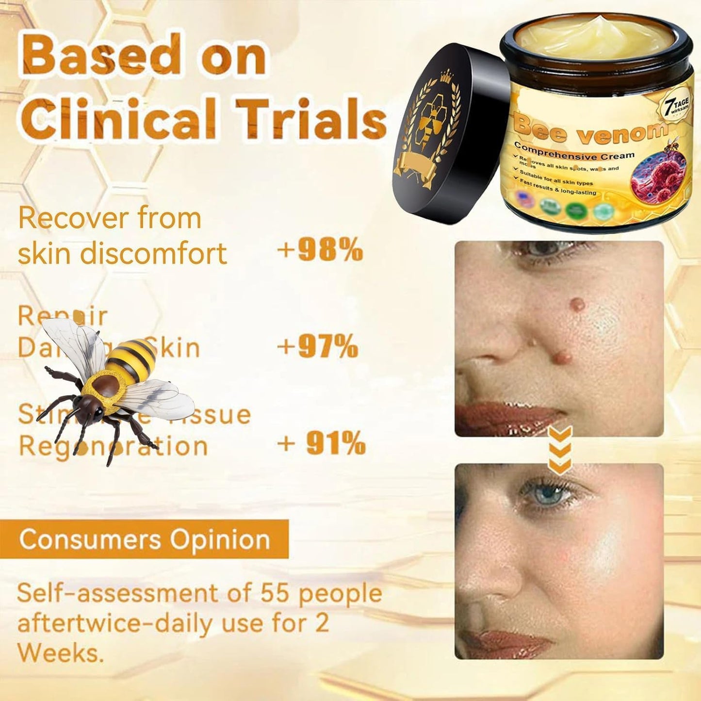 Bee Venom Comprehensive Bee Cream,2025 Professional Treatment Cream Wrinkle Removal Anti-Aging Moisturizing,Effective In Reducing Skin Blemishes (2PCS)-FemmiqueWomen