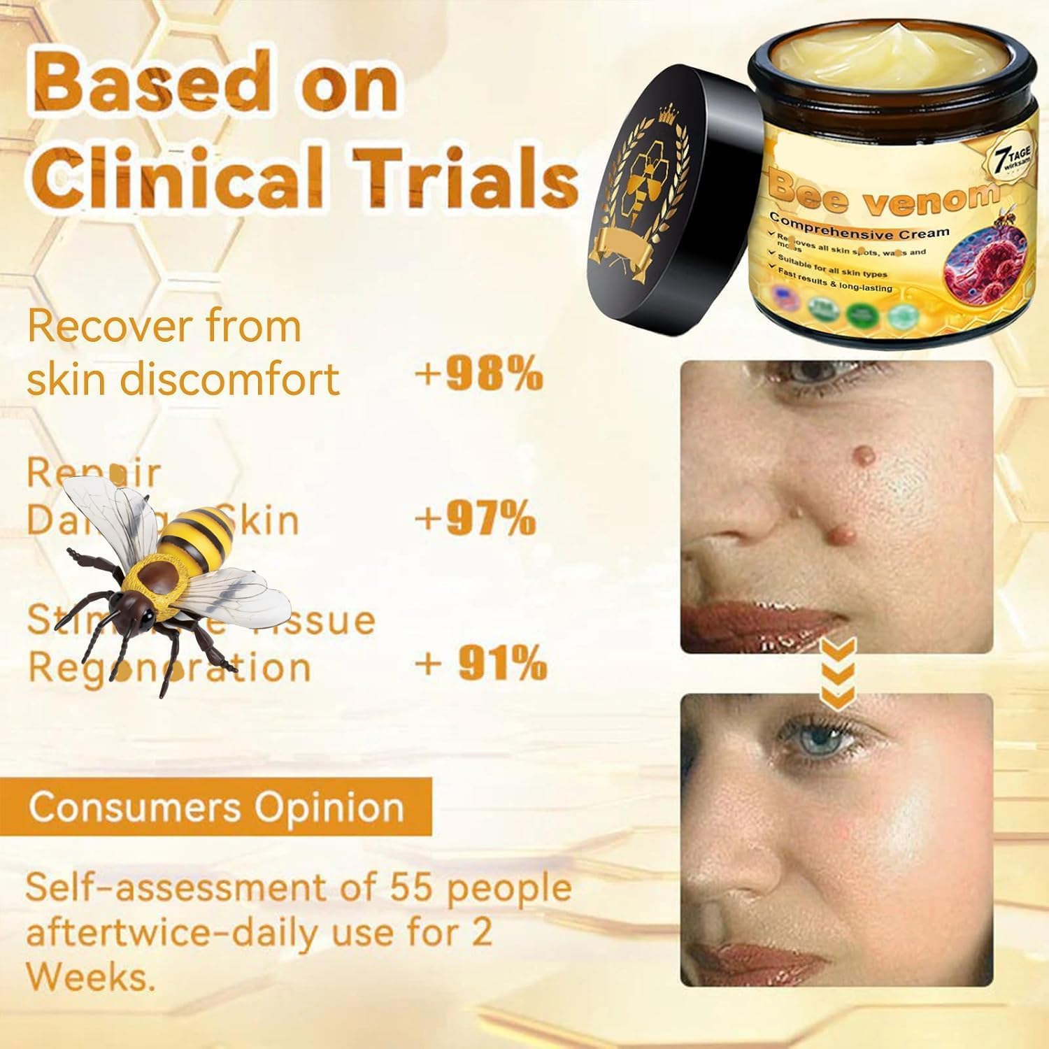 Bee Venom Comprehensive Bee Cream,2025 Professional Treatment Cream Wrinkle Removal Anti-Aging Moisturizing,Effective In Reducing Skin Blemishes (2PCS)-FemmiqueWomen