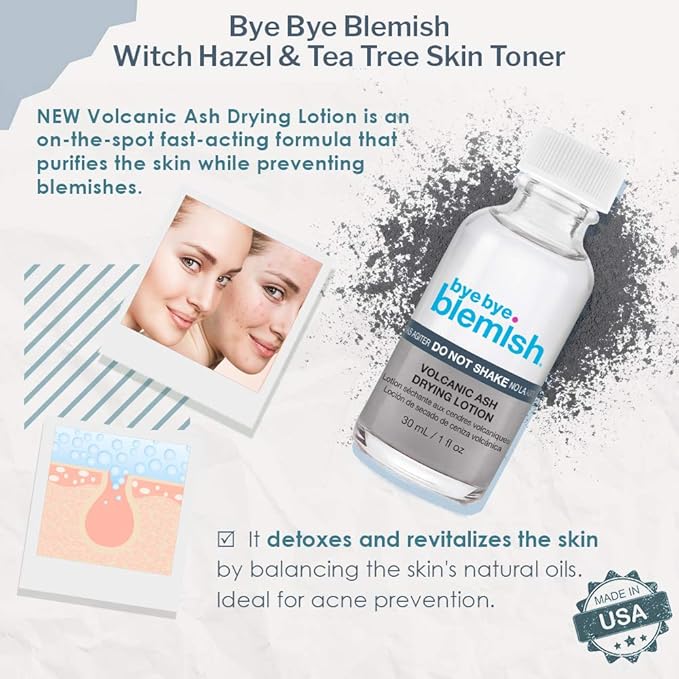 Bye Bye Blemish Drying Lotion Volcanic Ash | Acne Drying Solution To Assist With Blemish Prevention | 1 Fl. Oz.-FemmiqueWomen