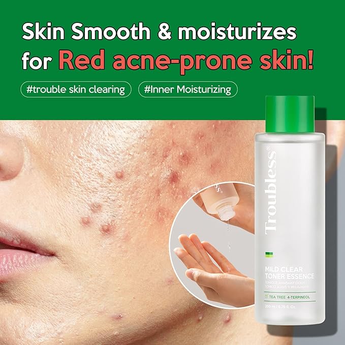 Troubless Mild Clear Toner Essence - Tea Tree Facial Toner for All Skin Types | Hydrating Skin Toner, Daily Skin Care (6.76 fl oz)-FemmiqueWomen