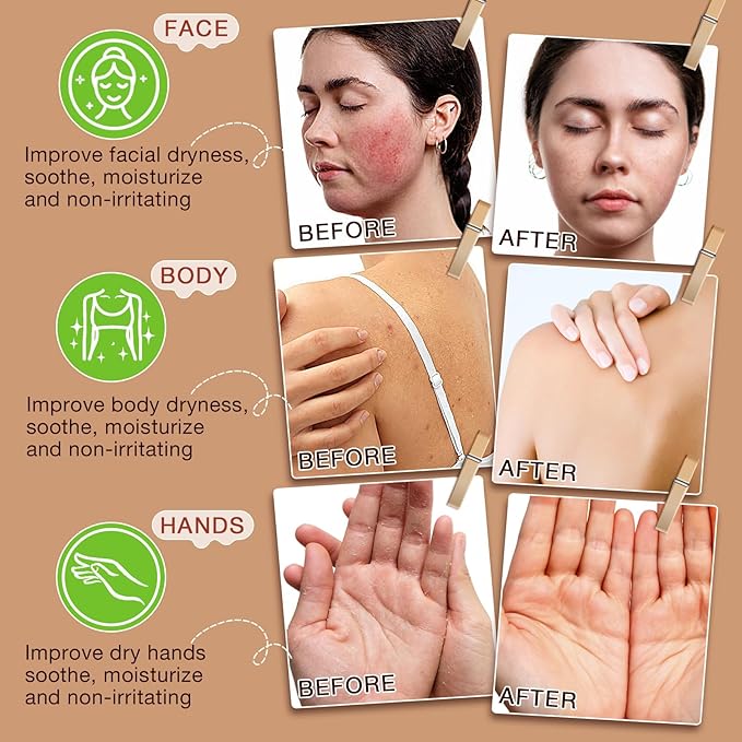 Beef Tallow for Skin,Tallow and Honey Balm,Beef Tallow for Face,Tallow Face Moisturizer,Natural Moisturizer Hydrates,Deeply Nourishes the Skin, Enhances Natural Radiance (1pcs)-FemmiqueWomen