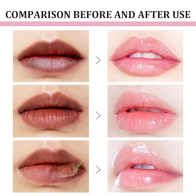 2pcs Lip Lightening for Dark Lips Lip Brightener for Smokers Dark Lip Treatment Lightening Cream for Pink Lips Lip Lightener for Smoker Lips Lip Lightening balm for Men and Women (Orange)-FemmiqueWomen