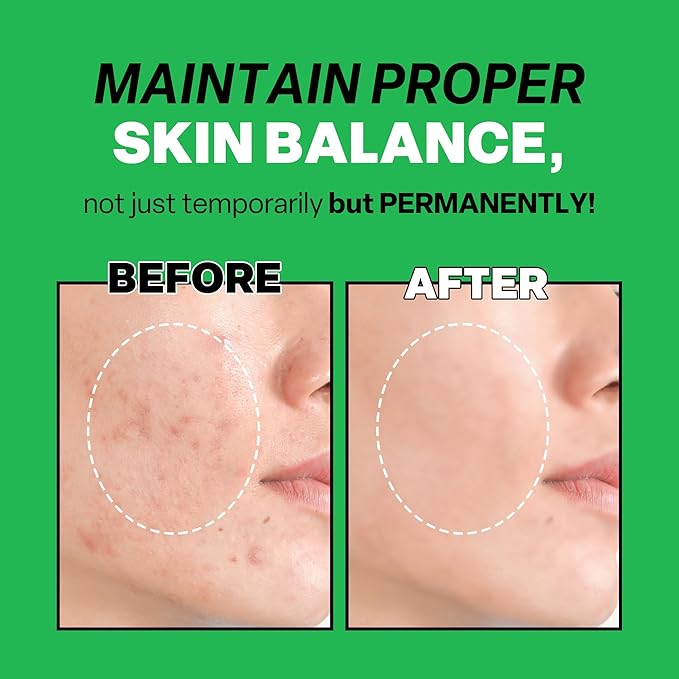 Troubless Mild Clear Toner Essence - Tea Tree Facial Toner for All Skin Types | Hydrating Skin Toner, Daily Skin Care (6.76 fl oz)-FemmiqueWomen