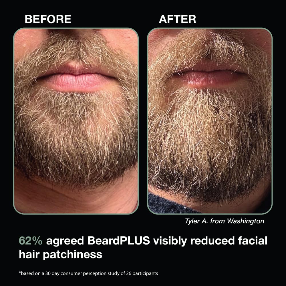ZEUS BeardPLUS Shampoo for Men, Enhanced Beard Growth & Hair Care Treatment with Biotin & Caffeine to Boost Thickness, Strength, Hydration, and Skin Comfort (Made in USA) 6 oz.-FemmiqueWomen