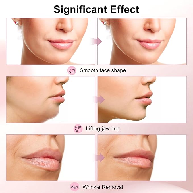 2025 Multi-Functional Face Lifting Device, V Roller Face Lift, Tightening, Skin Care, Double-Sided Roller Design, Type-C Fast Charging, Portable Beauty Device with 3 Adjustable Settings (White)-FemmiqueWomen