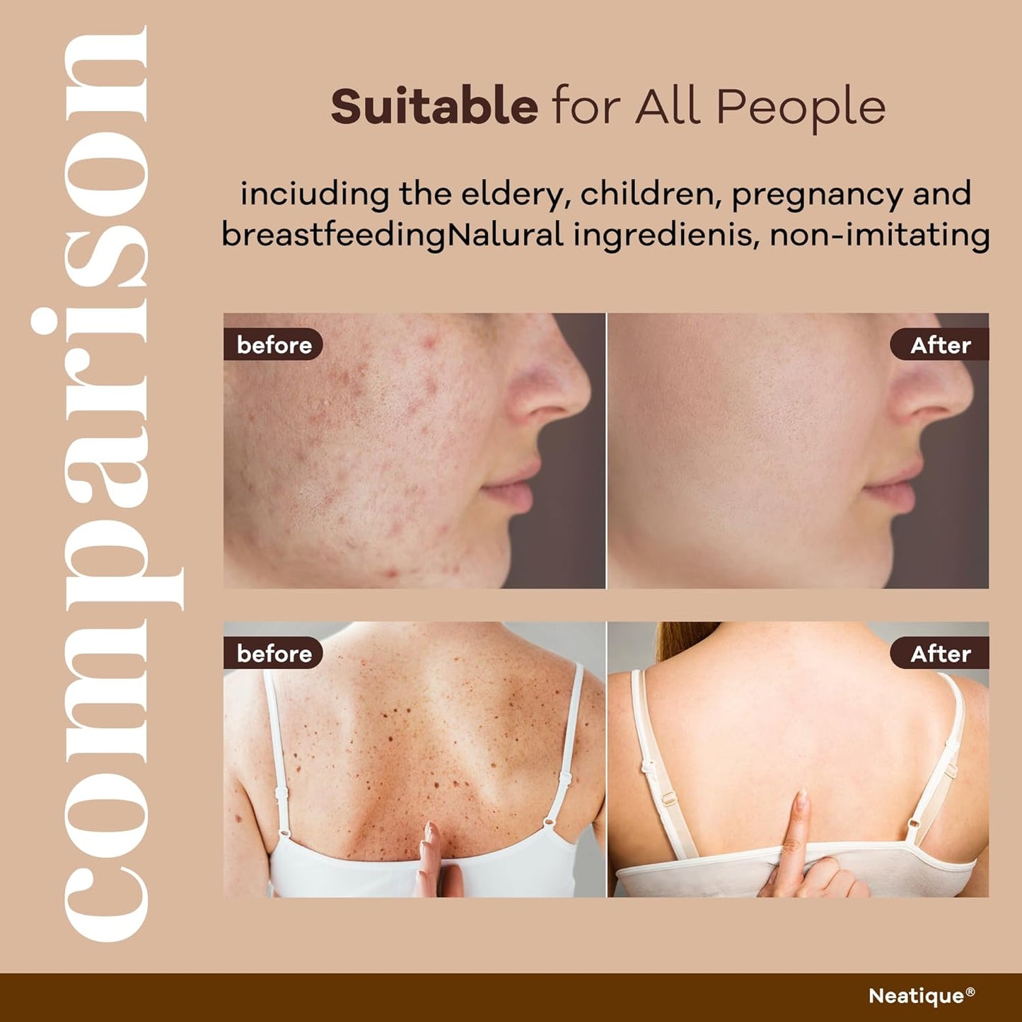 Bee Venom & Hyaluronic Acid Anti-Aging Face Cream – 2025 New Renewal Formula, Skin Moisturizer, All Skin Types, 2.12 Oz (60g)-FemmiqueWomen