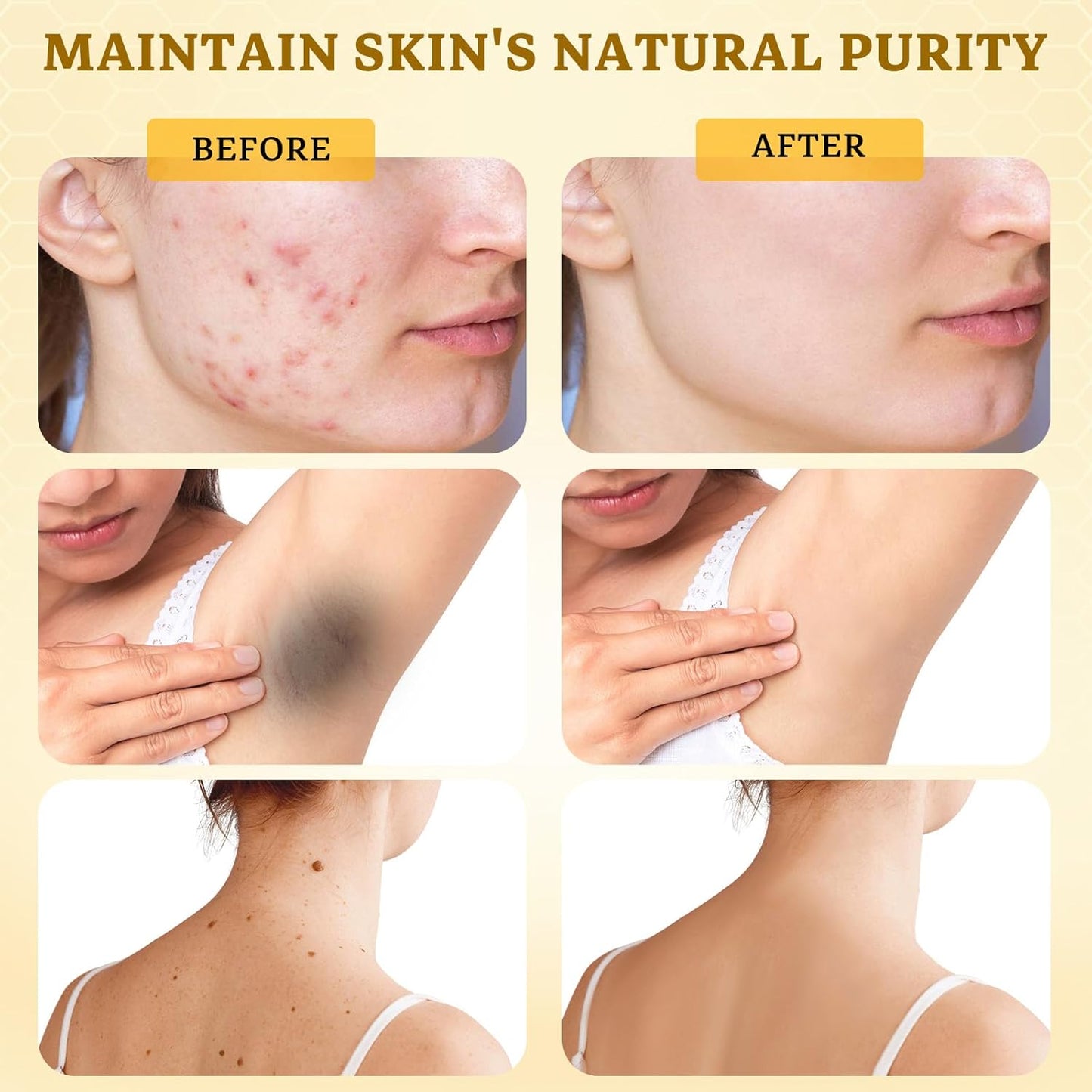 2PCS Bee Venom Comprehensive Cream: Wrinkle Care Face Lift & Firming, Effective In Reducing Skin Blemishes, Natural Care and Non-Irritating, Bee Venom Joint Cream for All Body Parts, 60g * 2PCS-FemmiqueWomen